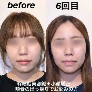 経堂鍼灸整体院 古木のエステ・リラクイメージ