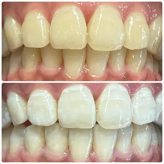 PLATINUM Beauty 横浜店所属・ホワイトニングルーム 横浜店のその他イメージ