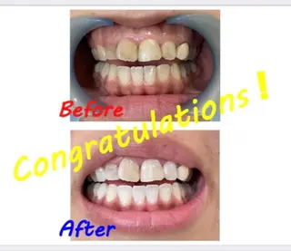 セルフホワイトニングサロン　ラヴィアン所属・ホワイトニングサロン La vie enのその他イメージ