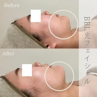 ciena KAYOのエステ・リラクイメージ