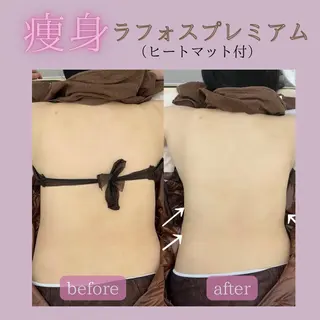 Total beauty salon  Brilliant所属・ブリリアント yuiのエステ・リラクイメージ