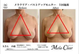 光美容シャムロック バスト、シミ専門店のエステ・リラクイメージ