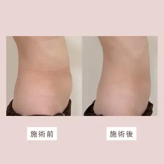 インディバサロン池袋西口所属・mitis+💐 インディバ池袋西口のエステ・リラクイメージ