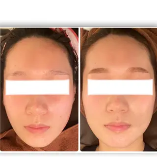 FLEUR大阪・整体 ・ハイフ・痩身・小顔のエステ・リラクイメージ