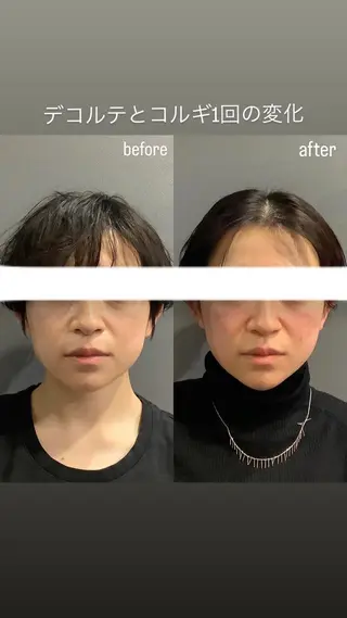 エステサロンino.colore'所属・小顔サロン ino.coloreのエステ・リラクイメージ