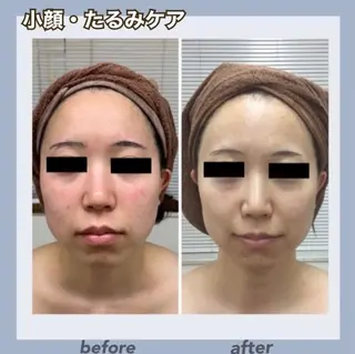 Age24to29 💗RAYVIS池袋のエステ・リラクイメージ