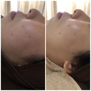 ショート カラー パーマ ヘアアレンジ メンズ キッズ ネイル マツエク・マツパ Amaryllis 🌹のエステ・リラクイメージ