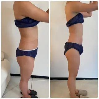 FLEUR大阪・整体 ・ハイフ・痩身・小顔のエステ・リラクイメージ