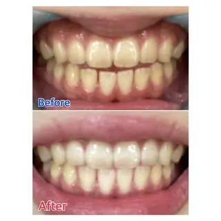 MBEAUTYSALON 千葉店・京成大久保所属・Melty 輝のその他イメージ