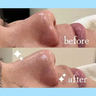 ファッショニスタ 中坪のエステ・リラクイメージ