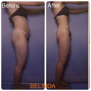 全身痩身✨ キレイサローネ表参道のエステ・リラクイメージ