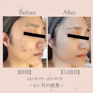 エステ＆美肌脱毛 ココサロ倉敷店のエステ・リラクイメージ