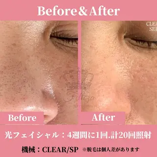 メンズ 有人型セルフサロン 脱毛/痩身/美顔のその他イメージ