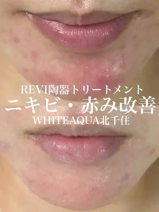 WHITE AQUA 北千住店のエステ・リラクイメージ