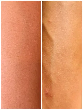 yellow.所属・yellow💛【 脱毛&フェイシャル】のエステ・リラクイメージ