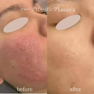 痩身/腸もみ/ ヘッドスパ/リンパのエステ・リラクイメージ