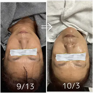 肌質改善サロン🌕 ⠀【ルーナピエナ】のエステ・リラクイメージ