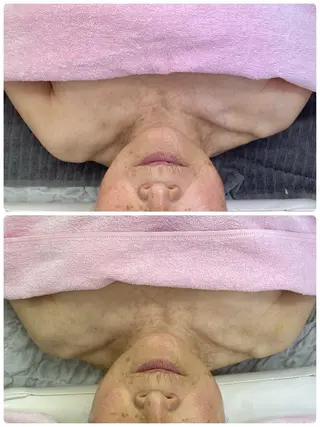 Salon Rion所属・Rion 野々村のエステ・リラクイメージ