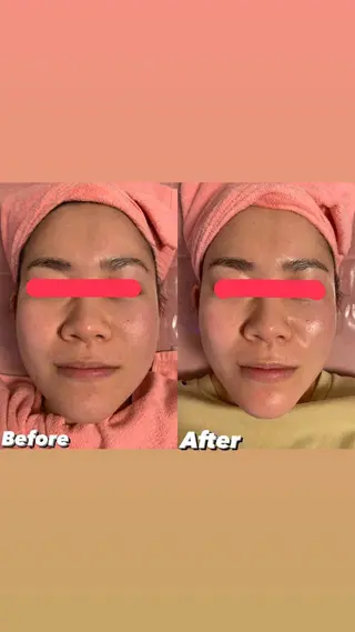 透明感の肌Lino malieのエステ・リラクイメージ