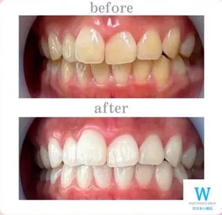 ホワイトニング ショップ本八幡店のエステ・リラクイメージ