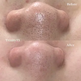 Liber Kyoto所属・魔法のシミ取り職人 CHIKAのマツエク・マツパデザイン