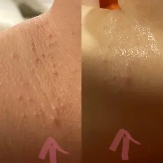 Mandarin Orange所属・毛穴から始める肌メン テマンダリンオレンジのエステ・リラクイメージ