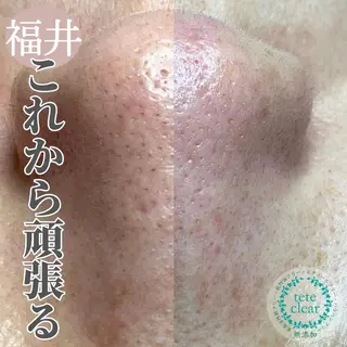 毛穴ケア専門サロン Yourmeユアミーのエステ・リラクイメージ