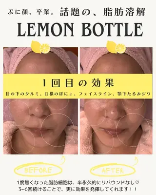 ell 東大阪所属・🎀BiBi韓国美容 コスパ強！美活サロンのエステ・リラクイメージ