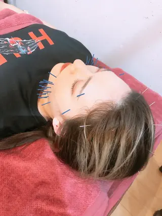 美容鍼灸女性専用 りんご鍼灸治療院のその他イメージ