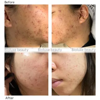 BIOLUXE BEAUTY所属・バイオラックス ビューティーのエステ・リラクイメージ