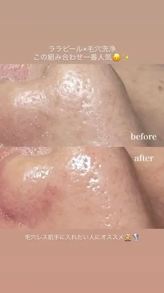 hitomi ヒトミのエステ・リラクイメージ