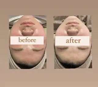 crescent所属・【韓国肌管理・脱毛】 クレセントのエステ・リラクイメージ