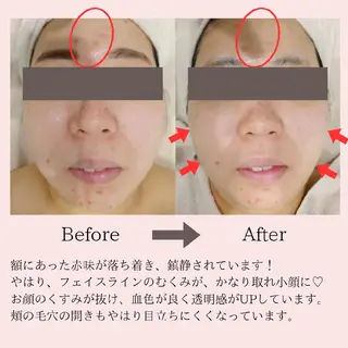 PRETTIEST SHINE所属・山田 浩子のエステ・リラクイメージ