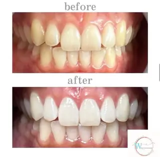 ホワイトニングショップ本厚木所属・ホワイトニング ショップ本厚木のその他イメージ