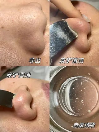Healing Space  Easen所属・Healing Easenのエステ・リラクイメージ