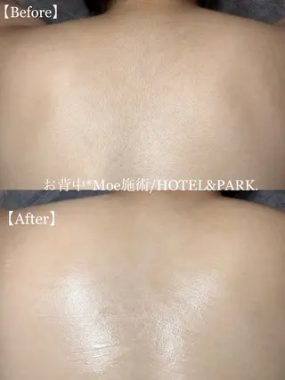 HOTEL&PARK . ワックス脱毛のエステ・リラクイメージ