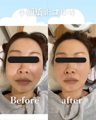 高岳/久屋大通　脱毛 コルギ🌿ENSHIのエステ・リラクイメージ