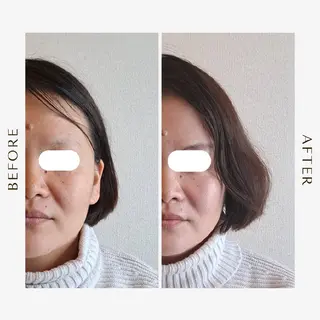 鍼灸サロンmiyabi所属・美容鍼×エステ　鍼灸 サロンmiyabiのエステ・リラクイメージ