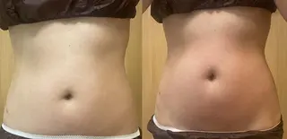 OPREA 千種店のエステ・リラクイメージ