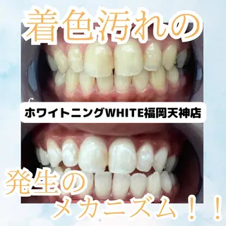 メンズ ホワイトニング専門店 WHITE天神店のエステ・リラクイメージ