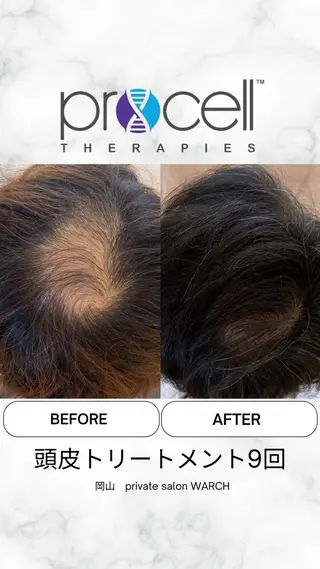 WARCH Marieのその他イメージ