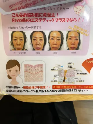 Meetite 小林のエステ・リラクイメージ