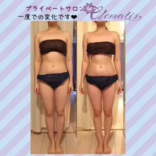 ショート カラー パーマ ヘアアレンジ メンズ キッズ ネイル マツエク・マツパ 強圧オールハンド痩身&黄土よもぎ蒸しプライベートサロンClematis池袋所属・強圧オールハンド痩身 片野のエステ・リラクイメージ