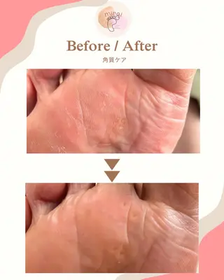 フットケアサロン miraiのその他イメージ