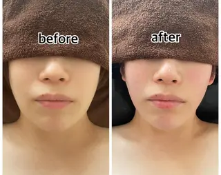 💎インディバ GEM💎indiba healing room GEM所属・💎 GEM💎のエステ・リラクイメージ