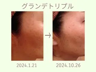 ラブニール 恵比寿店のエステ・リラクイメージ