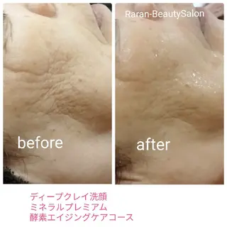 若返り 美肌   エステサロンららんのエステ・リラクイメージ