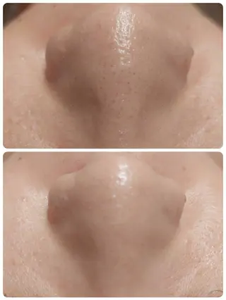 MyFairLady miuのエステ・リラクイメージ