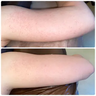 FLEUR大阪・整体 ・ハイフ・痩身・小顔のエステ・リラクイメージ