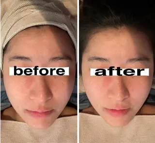 食べながら魅せボディ éclatJua川越のエステ・リラクイメージ